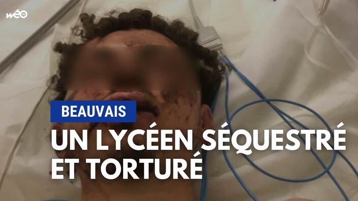 Un jeune de 17 ans séquestré et torturé dans une cave à Beauvais